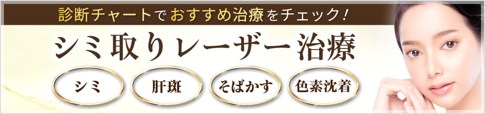 診断チャートでおすすめ治療をチェック 「シミ取りレーザー特集」 シミ、肝斑、そばかす、色素沈着