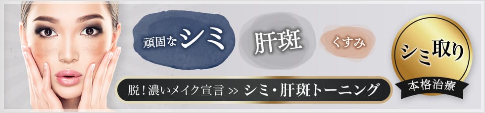 頑固なシミ・肝斑・くすみ 脱！濃いメイク宣言 シミ・肝斑トーニング シミ取り本格治療