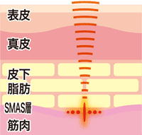 点状方式