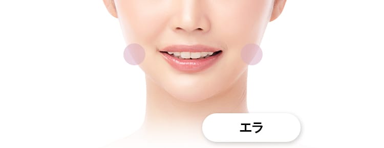 【アラガン社ボツリヌス注射】プチ小顔処置部位:エラ【画像】
