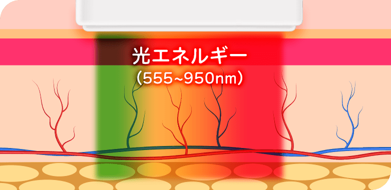 従来のIPL治療ではできなかった薄いシミも改善