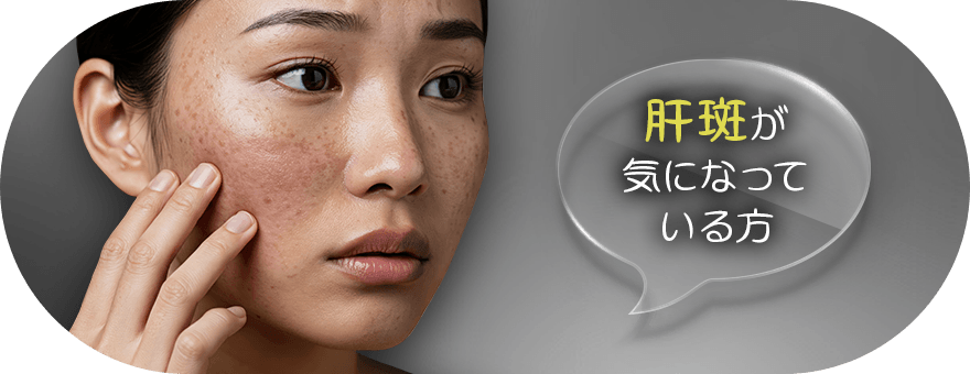 肝斑に悩んでいる