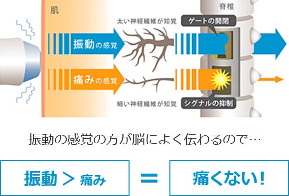 バイブレーション機能で痛みを軽減【画像】
