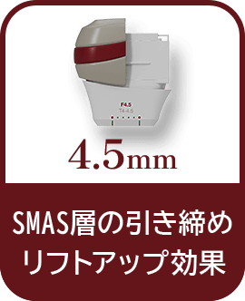 4.5mm SMAS層の引き締め・リフトアップ効果