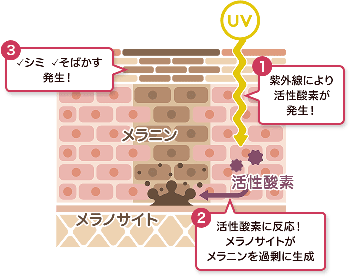 シミができる原因は？【画像】