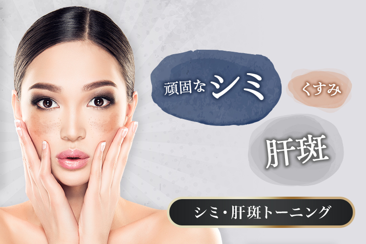脱!濃いメイク宣言 頑固なシミ・肝斑・くすみ シミ取り本格治療 しみ・肝斑トーニング