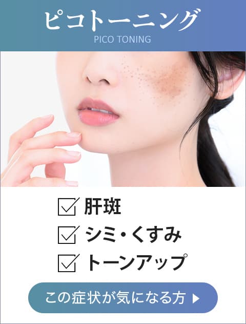 ピコトーニング 肝斑、シミ・そばかす、くすみ この症状が気になる方【画像】