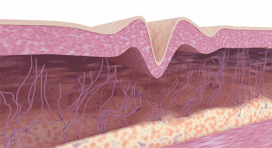 POINT1 2~3回目からより効果が実感できるようになる